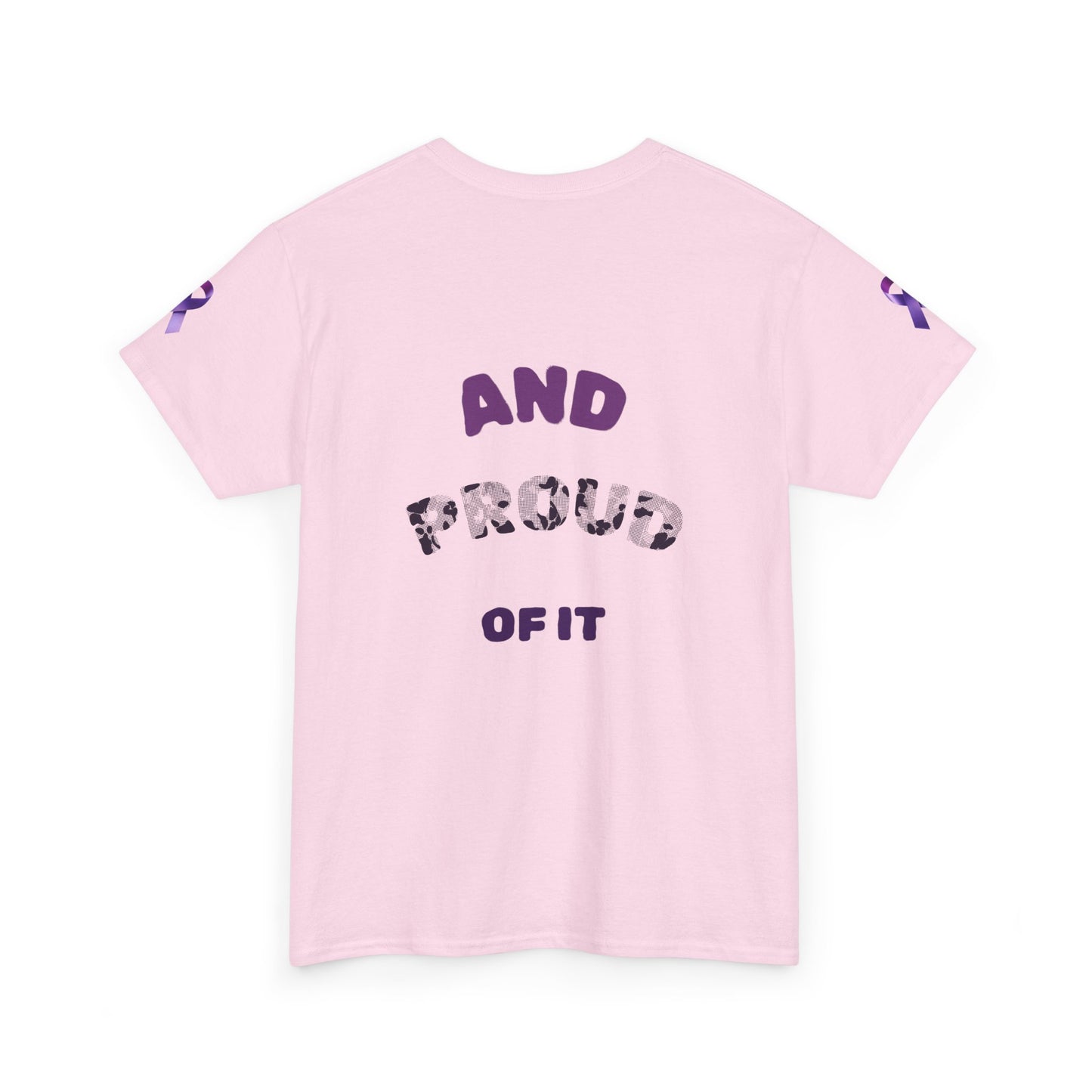 Supporter for Purple Unisex Tee, Comfortable Cotton T-Shirt for Lupus Awareness, Casual Wear, Gifts for Allies, [...]