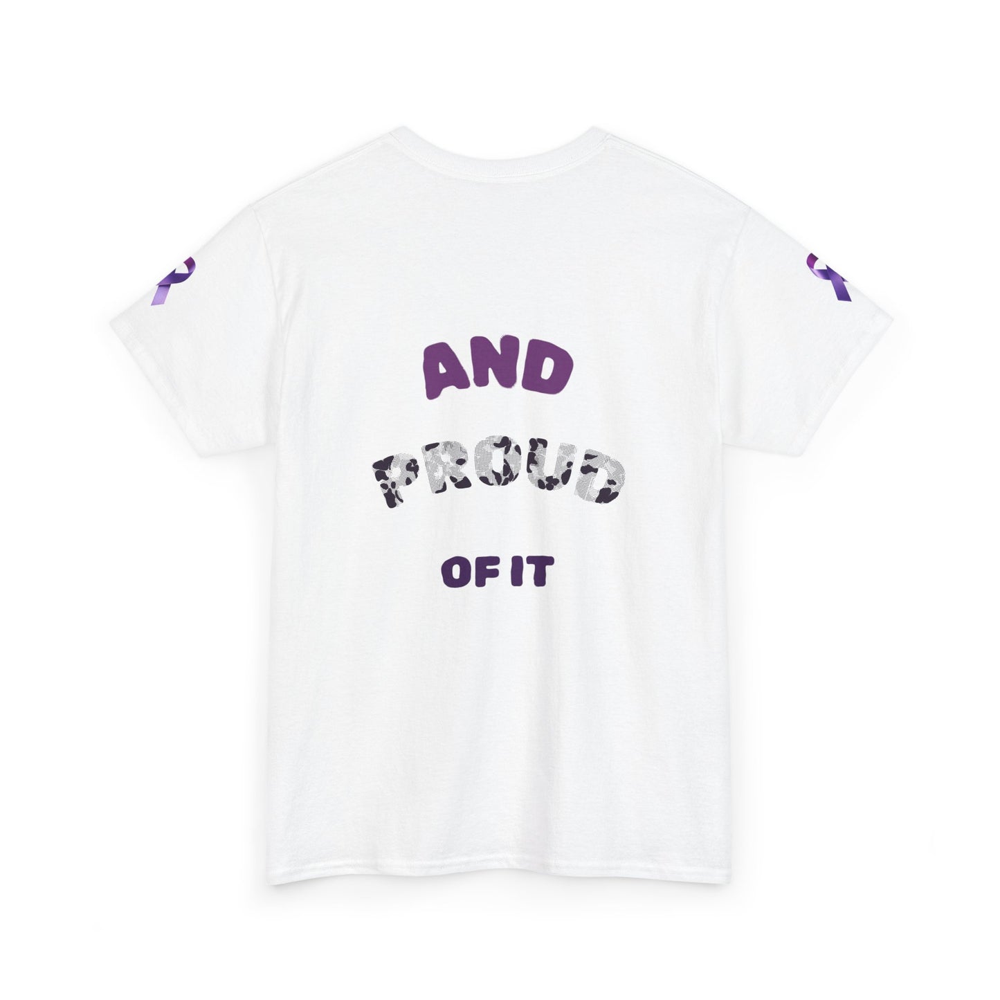 Supporter for Purple Unisex Tee, Comfortable Cotton T-Shirt for Lupus Awareness, Casual Wear, Gifts for Allies, [...]